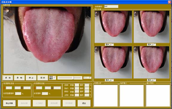 中醫(yī)舌診儀舌象采集界面