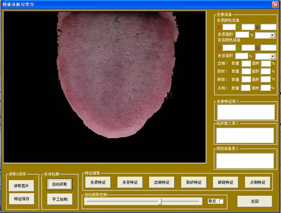 中醫(yī)舌像采集分析儀分析與學(xué)習(xí)界面