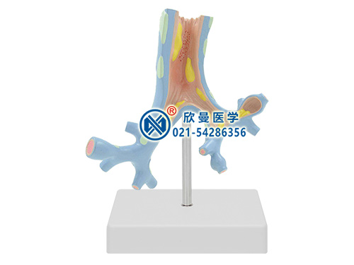 支氣管病理模型
