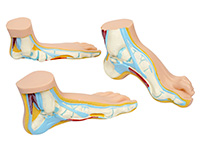 足弓模型 正常足弓形足扁平足