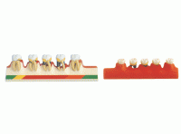牙周病模型 牙周病分類模型